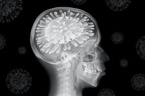 Coronavirus: the pandemic is changing our brains –  here are the remedies