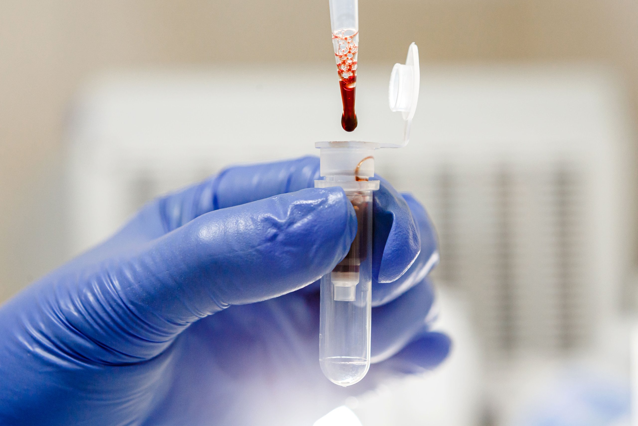 Labgrown blood given to humans in worldfirst trial aimed at