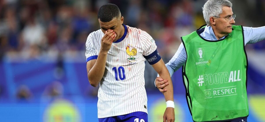 Kylian Mbappe rushed to hospital for surgery after Euro 2024 injury