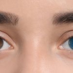 Eye colour-changing surgeries are nothing to blink at – they could leave you blind