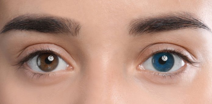 Eye colour-changing surgeries are nothing to blink at – they could leave you blind