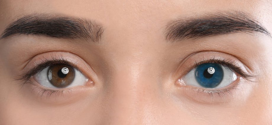 Eye colour-changing surgeries are nothing to blink at – they could leave you blind