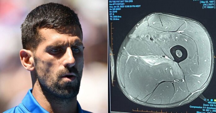 Novak Djokovic releases MRI scan blasting John McEnroe and other 'experts'