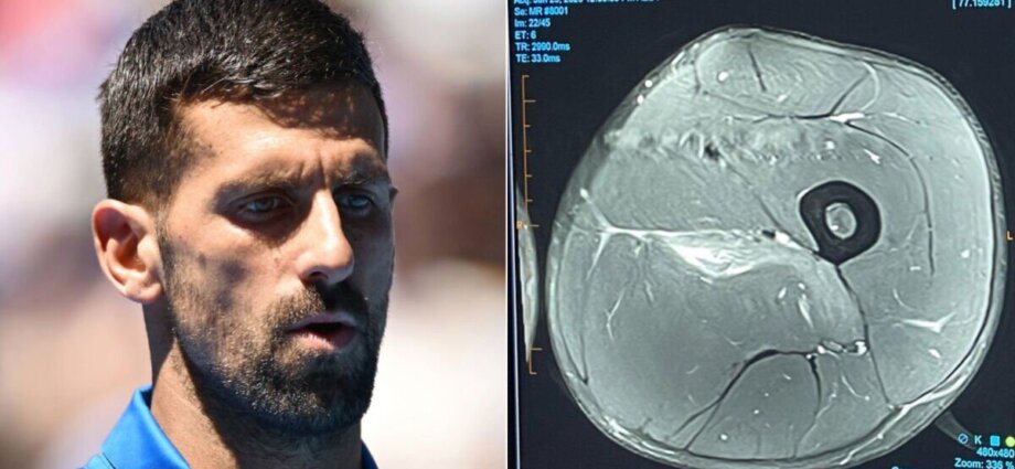 Novak Djokovic releases MRI scan blasting John McEnroe and other 'experts'