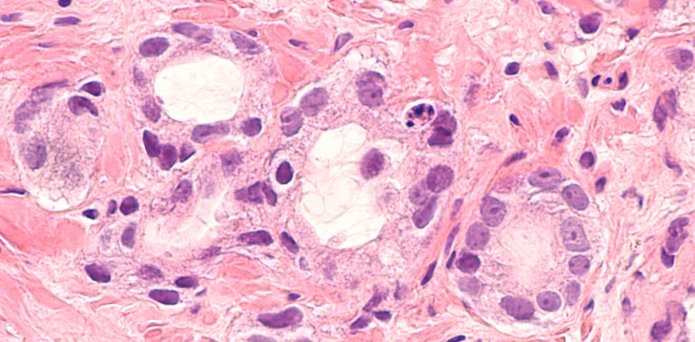 Why rapid at-home PSA tests for prostate cancer are fast, convenient – and unreliable