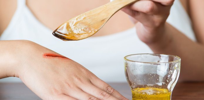 How to treat a wound – without using superglue, grout or vodka, like some people