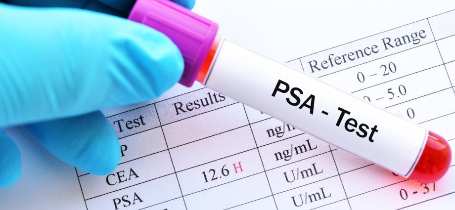 Prostate cancer screening rejected by UK government advisers – here’s why