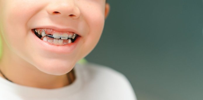 The ancient braces myth: why our ancestors didn’t need straight teeth