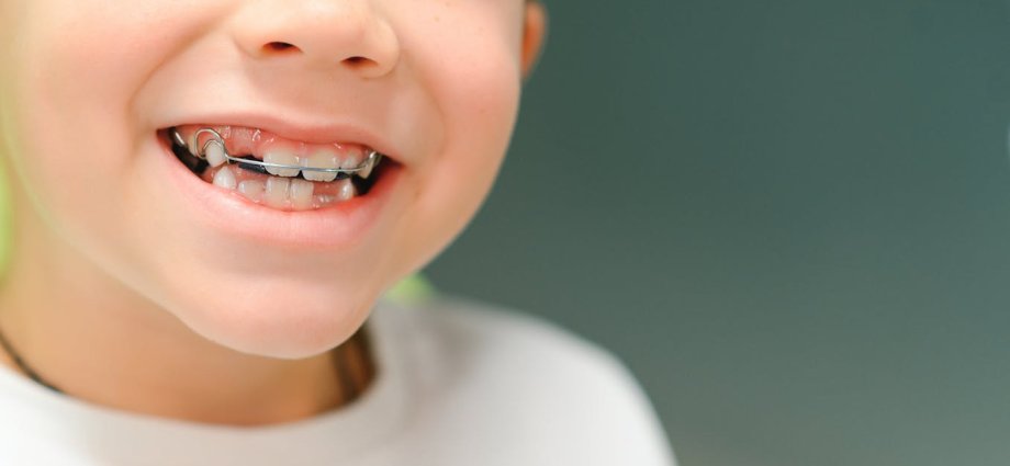 The ancient braces myth: why our ancestors didn’t need straight teeth