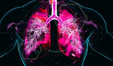 Chronic obstructive pulmonary disease develops over decades – and we are missing the window to prevent it