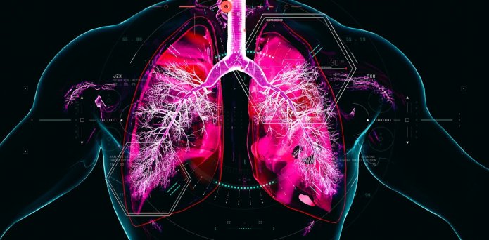 Chronic obstructive pulmonary disease develops over decades – and we are missing the window to prevent it