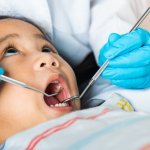 The mysterious tooth condition affecting millions of children