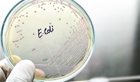 Nature has spent billions of years fighting bacteria – AI could help us learn its secrets
