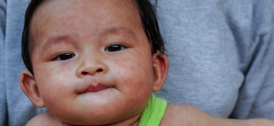 Vaccines have been so successful that some people have forgotten why we need them